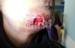 Ηράκλειο -αστυνομικός