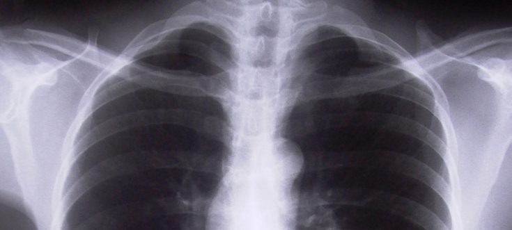 ακτινογραφία