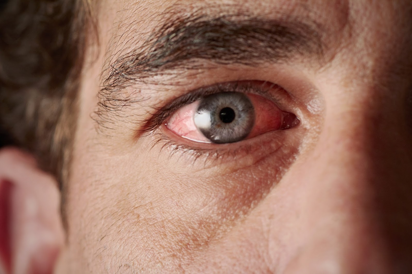 Τα μάτια μαρτυρούν τον κίνδυνο πρόωρου θανάτου – Τι έδειξε έρευνα
