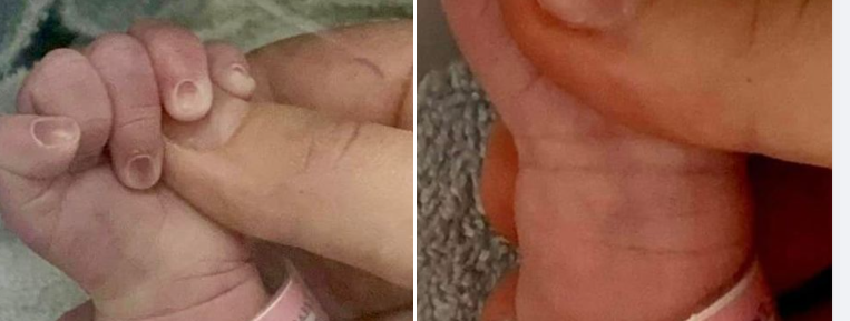 Βουλευτής απέκτησε δίδυμα – Η πρώτη φωτογραφία των μωρών