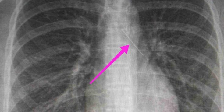 Θεσσαλονίκη καρφίτσα