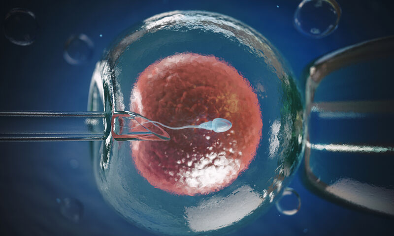 εξωσωματική γονιμοποίηση