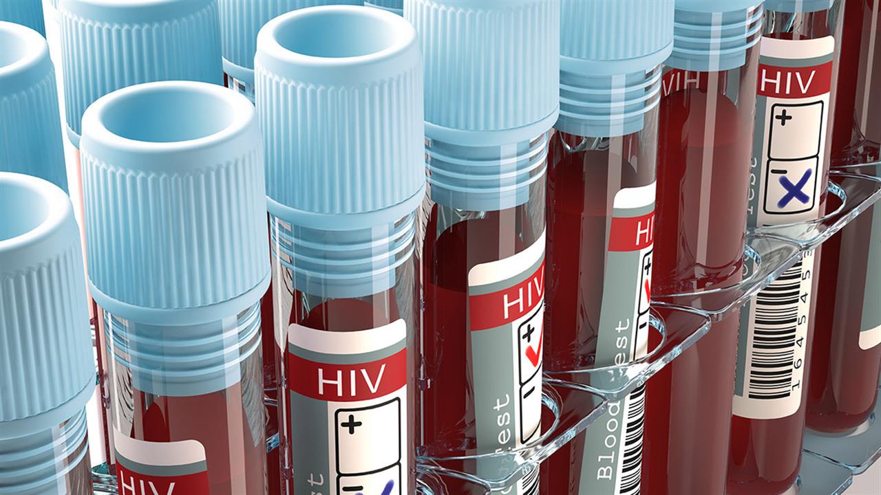 Ευρωπαϊκή Εβδομάδα Εξέτασης για τον HIV από τις 21 έως τις 28 Νοεμβρίου