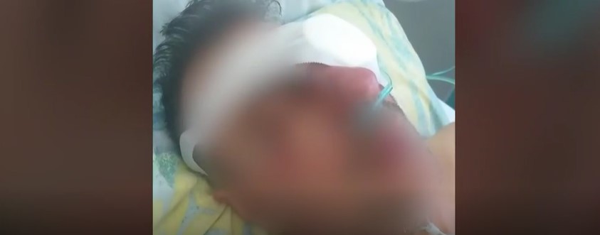 Εφιάλτης για 47χρονο στην Κρήτη – Αρνήθηκε ένα κέρασμα και του έβγαλε το μάτι με το δάχτυλό του