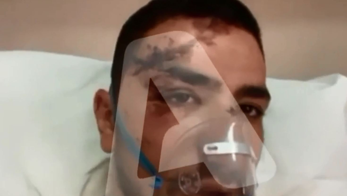 Σοκαριστικό τροχαίο στην Κερατέα: «Πονάω ολόκληρος» λέει ο διανομέας που τραυματίστηκε σοβαρά