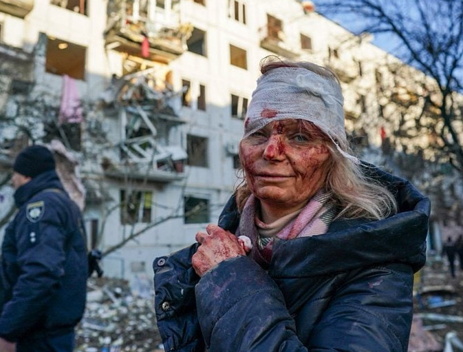 Πόλεμος στην Ουκρανία: Το πικρό χαμόγελο – Η φωτογραφία που συγκλονίζει τον πλανήτη