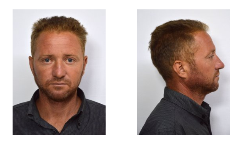 Πάτρα: Αυτός είναι ο Ρουμάνος που άρπαξε την 6χρονη από γειτονικό σπίτι και ασέλγησε σε βάρος της