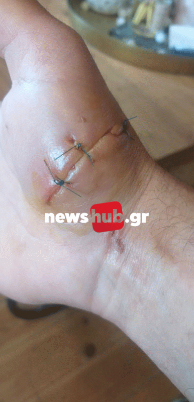 σκύλος- επίθεση