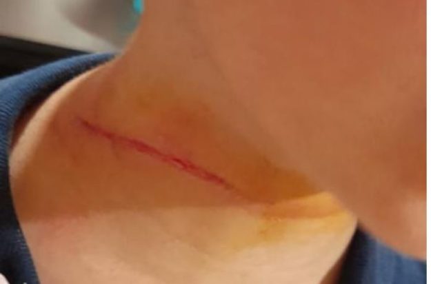 Κρήτη- σκύλος- 7χρονος