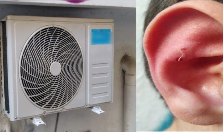 Ατύχημα για 10χρονο στη Λάρισα: Τραυματίστηκε από εξωτερική μονάδα κλιματισμού – Τι καταγγέλλει η μητέρα