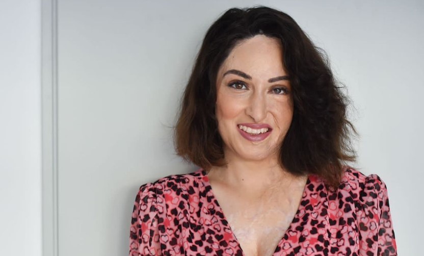 Ιωάννα Παλιοσπύρου: Ήταν μεγάλη ανακούφιση για εμένα να επικοινωνήσω τη νέα μου εικόνα