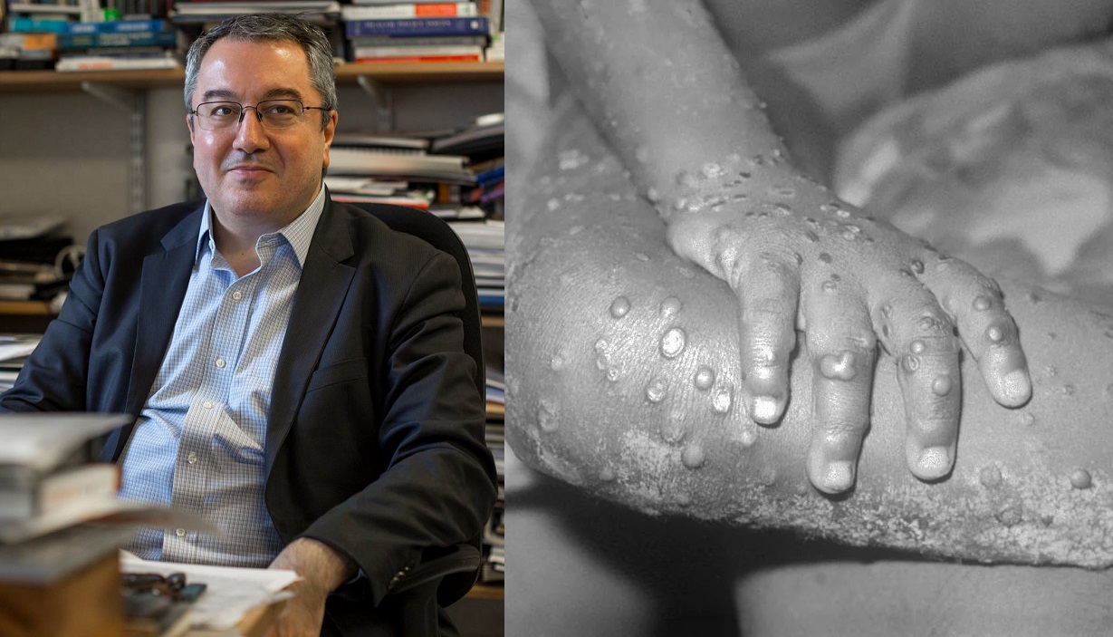 Ηλίας Μόσιαλος: Η ευλογιά των πιθήκων δεν είναι “νόσος των gay” – ΒΙΝΤΕΟ