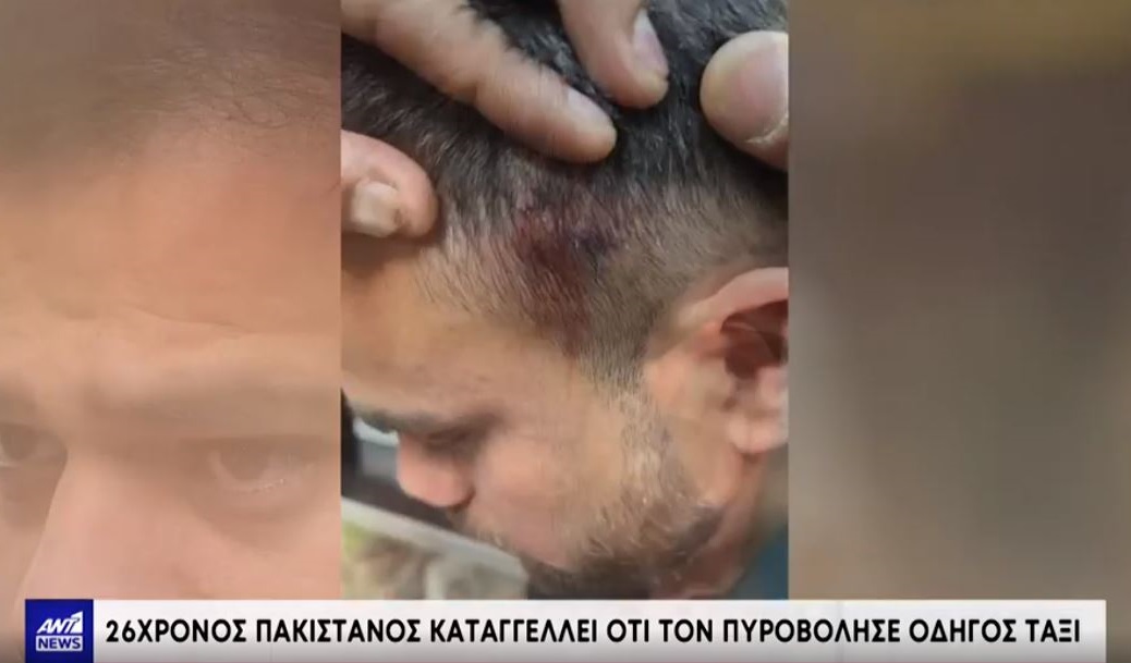 «Είμαι πολύ φοβισμένος»: Τι λέει ο Πακιστανός που καταγγέλλει ότι οδηγός ταξί τον πυροβόλησε