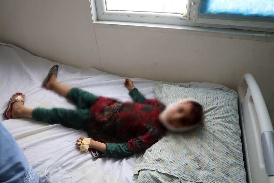 Αφγανιστάν: Σκοτώθηκαν 2 παιδιά και άλλα 8 τραυματίστηκαν – Έπαιζαν με όλμο