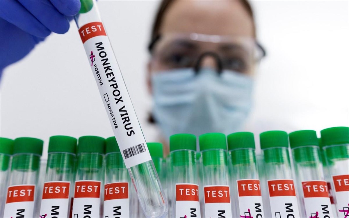 ευλογιάς των πιθήκων