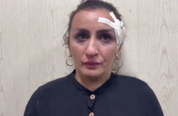 Ρωσία: Ήθελε να πουλήσει το μωρό της για να κάνει… πλαστική στη μύτη
