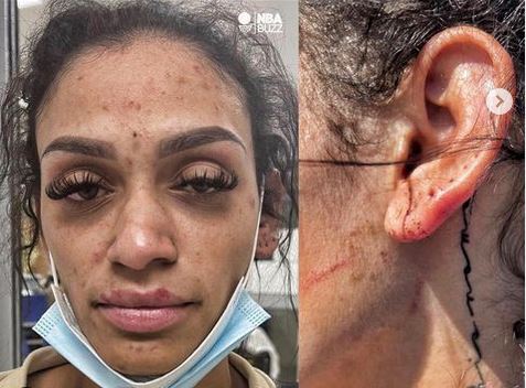 Σύλληψη αστέρα του ΝΒΑ για ενδοοικογενειακή βία