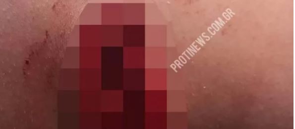 Κουρούτα- μαχαίρωμα