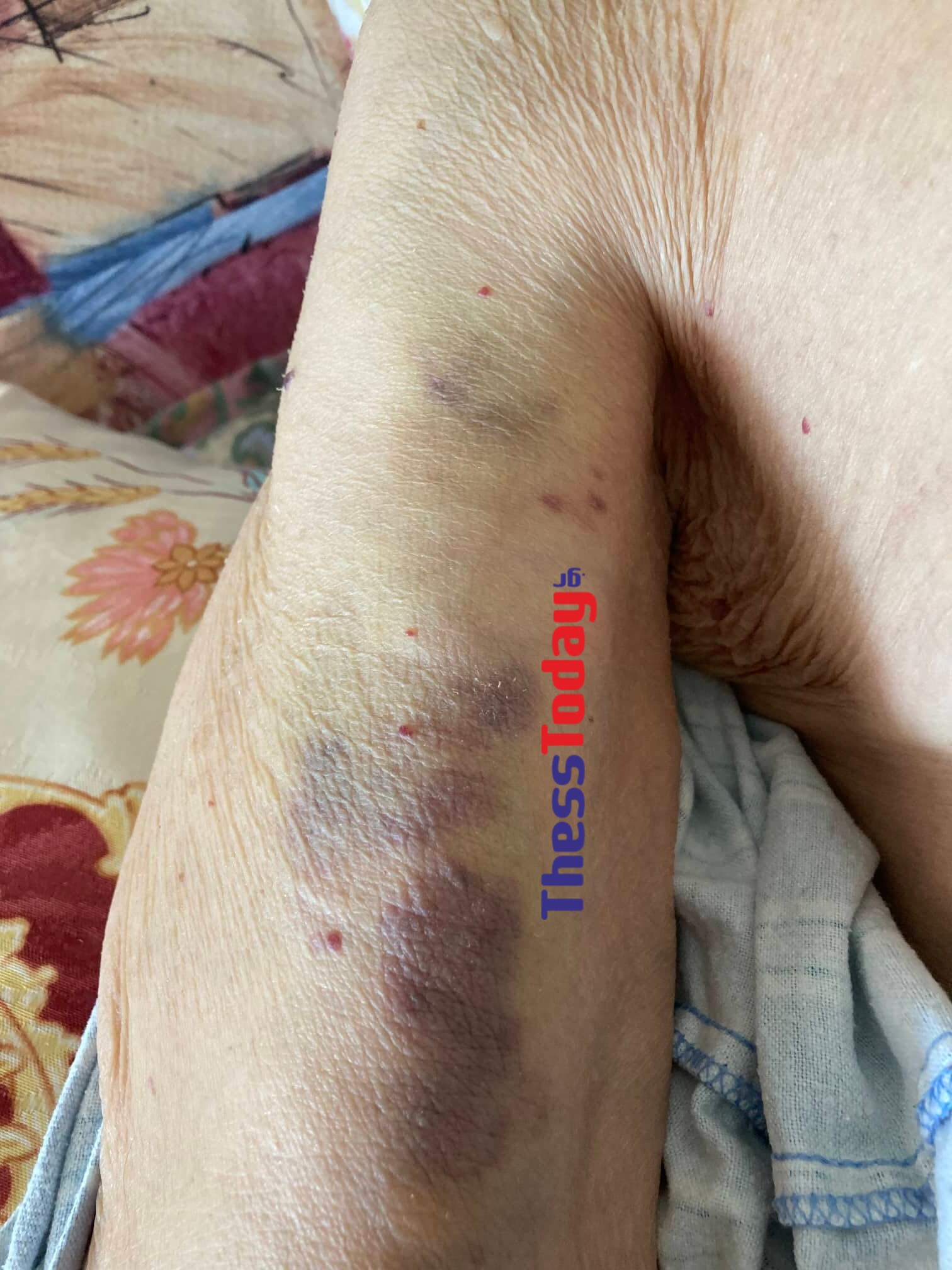 Κακοποίηση ηλικιωμένου