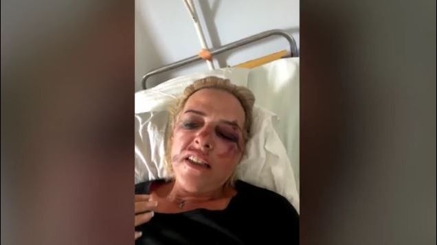 Θύμα επίθεσης από αδέσποτα