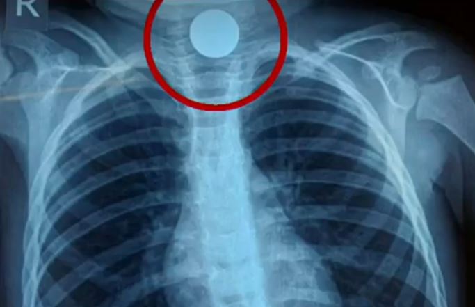 ακτινογραφία