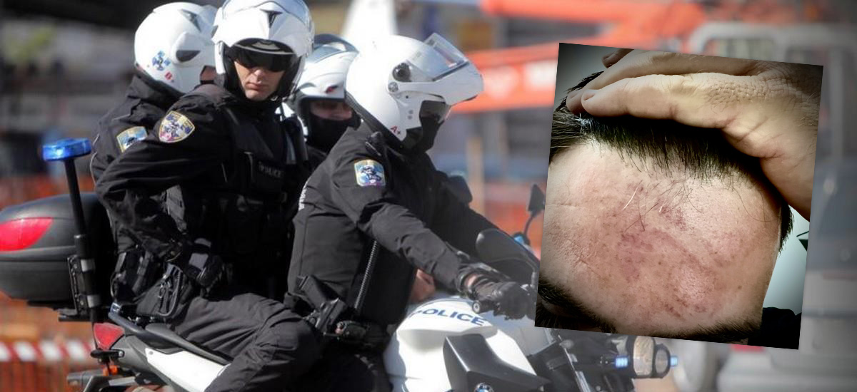 Αστυνομικός Επίθεση Λασίθι