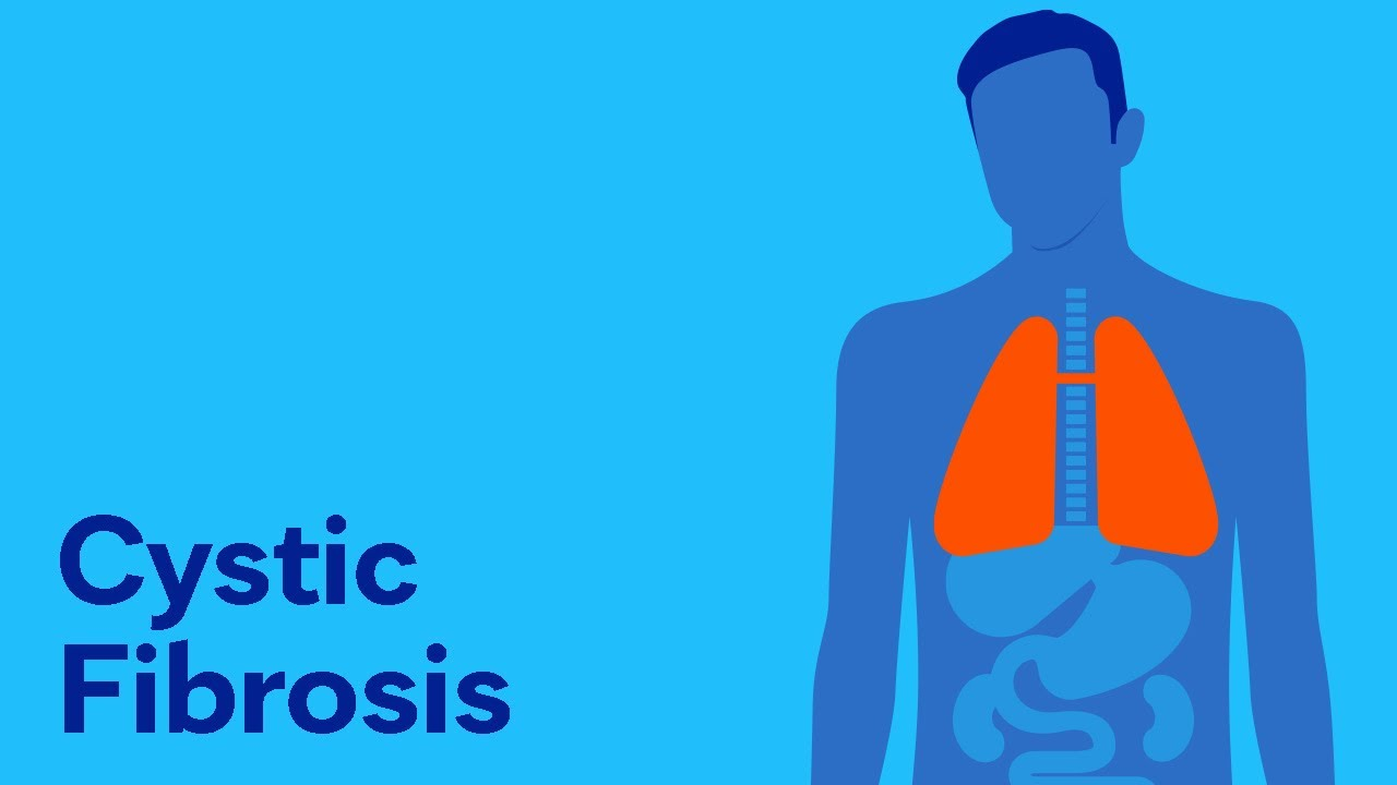Κυστική Ίνωση cystic fibrosis