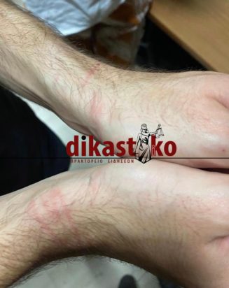 αστυνομική βία καταγγελία