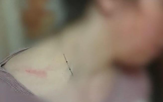 κακοποίηση Θεσσαλονίκη