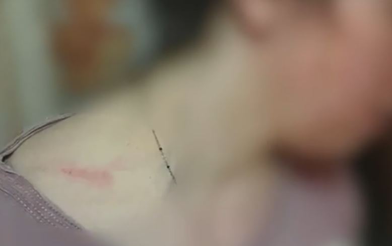 κακοποίηση Θεσσαλονίκη