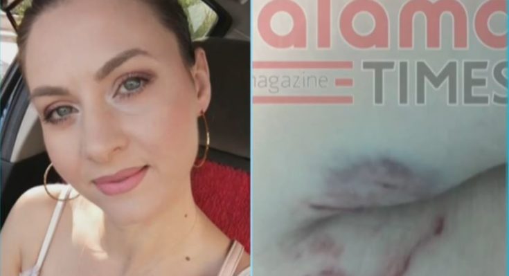 επίθεση από σκυλιά - Καλαμάτα