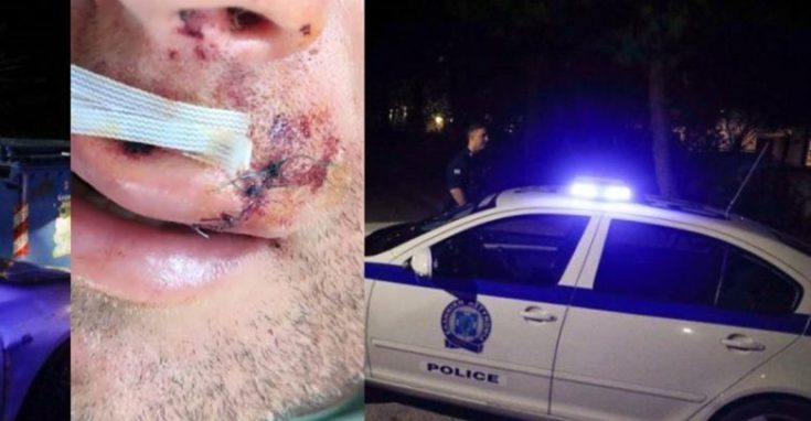 Λάρισα τραυματίες αστυνομικοί