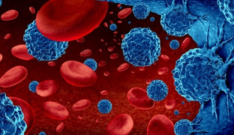 Όλα τα νεότερα επιστημονικά δεδομένα για το πολλαπλούν μυέλωμα στο 19ο παγκόσμιο συνέδριο