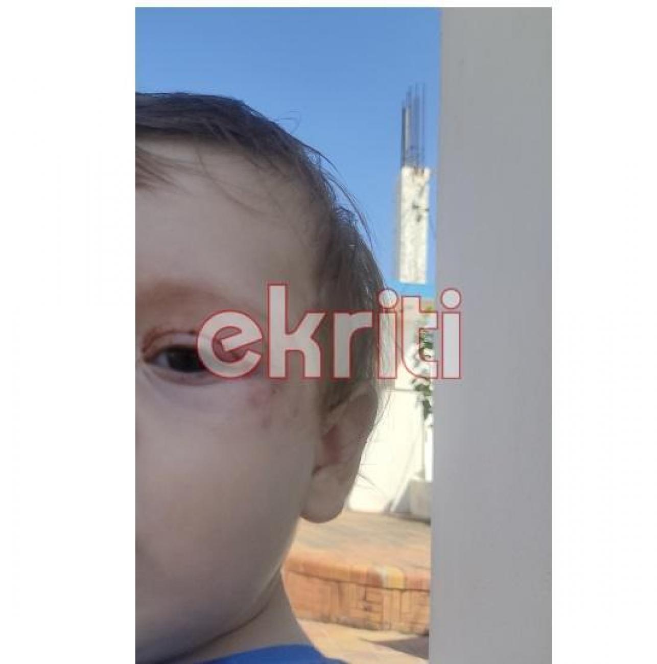 Επίθεση σε μωρό