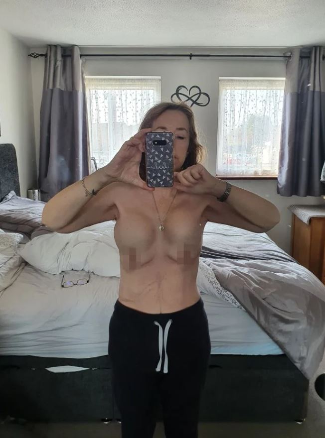 Πλαστική στην Τουρκία