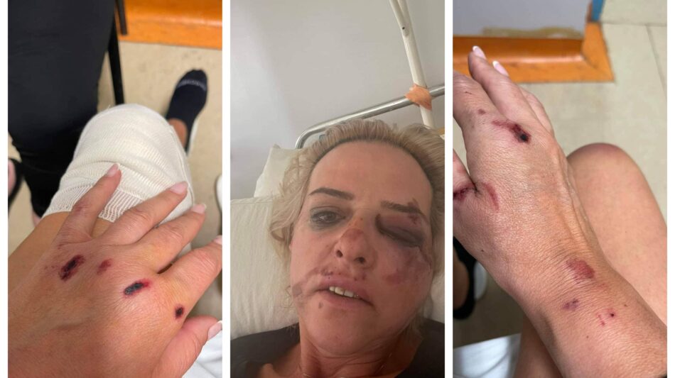 Νέα επίθεση αδέσποτων σκύλων στην Καλαμάτα – «Θυμάμαι τον τρόμο» περιγράφει το θύμα