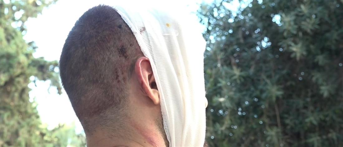 Allou Fun Park τραυματίας