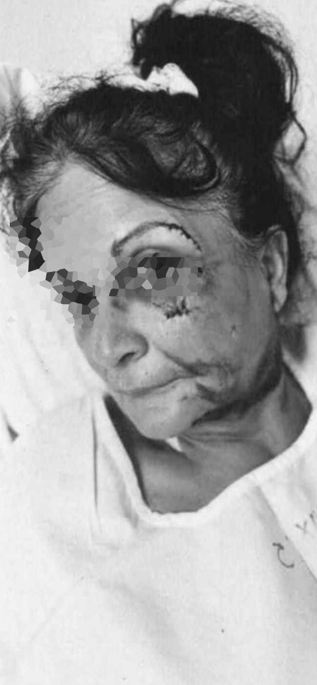 ξυλοδαρμός ξενοδόχου Αίγινα