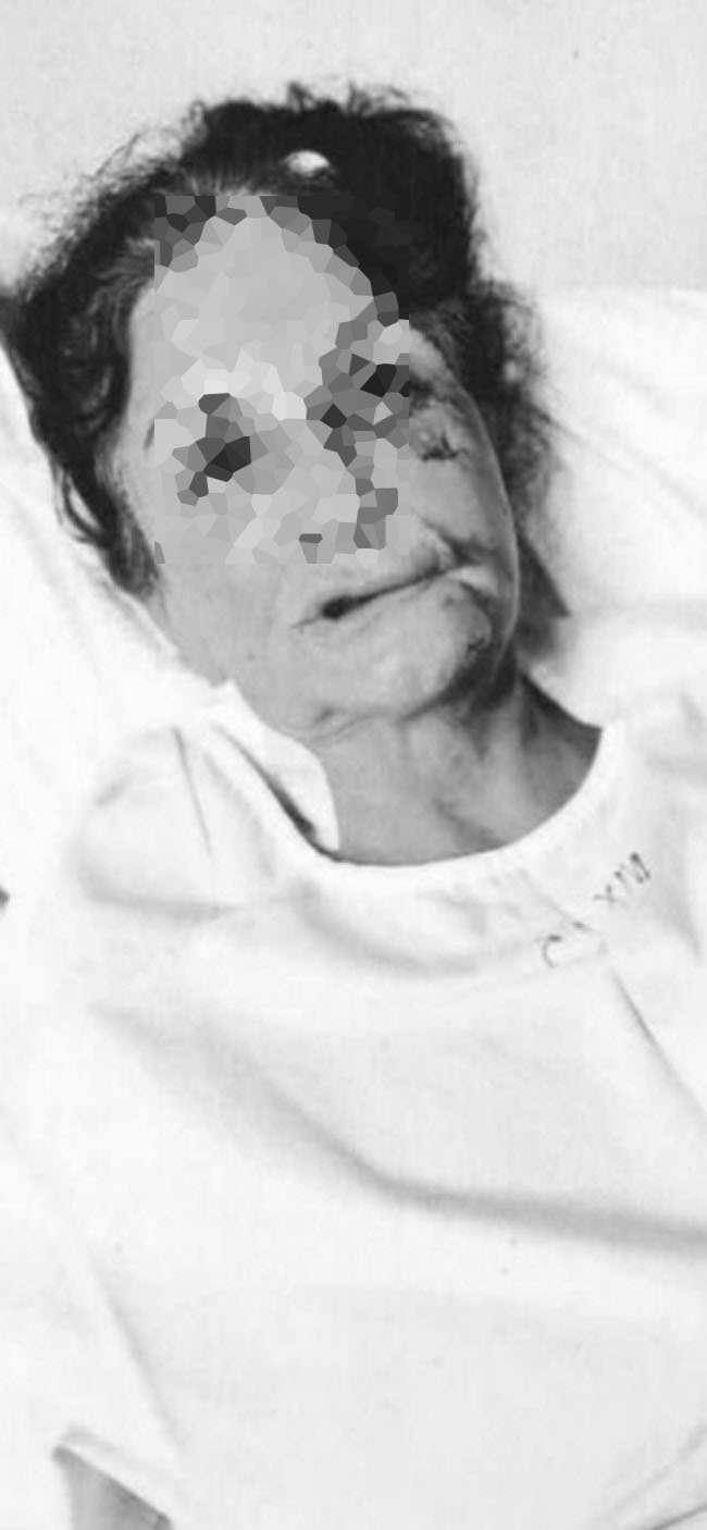 ξυλοδαρμός ξενοδόχου Αίγινα