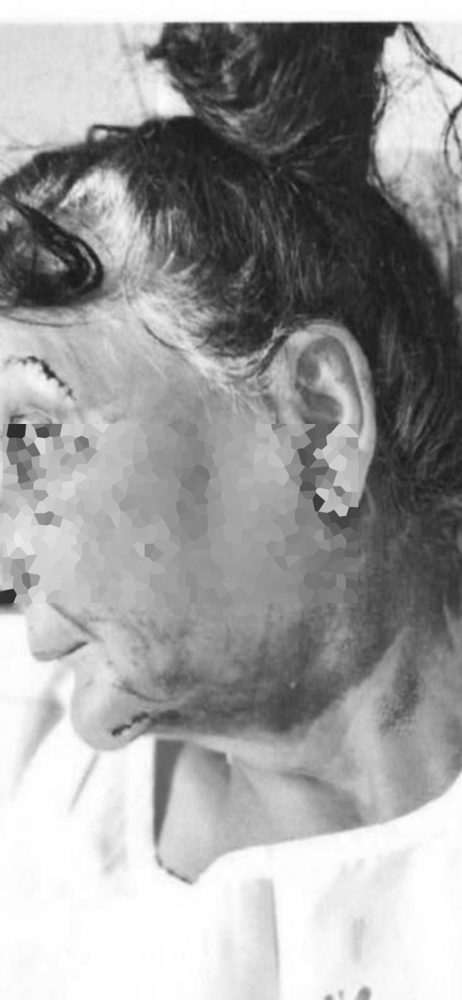 ξυλοδαρμός ξενοδόχου Αίγινα