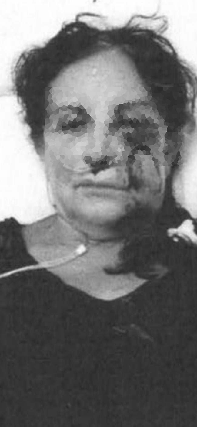 ξυλοδαρμός ξενοδόχου Αίγινα