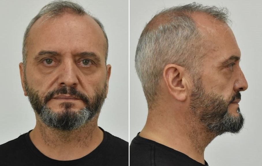 53χρονος στον Κολωνό