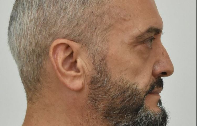 Κολωνός- κατηγορούμενος