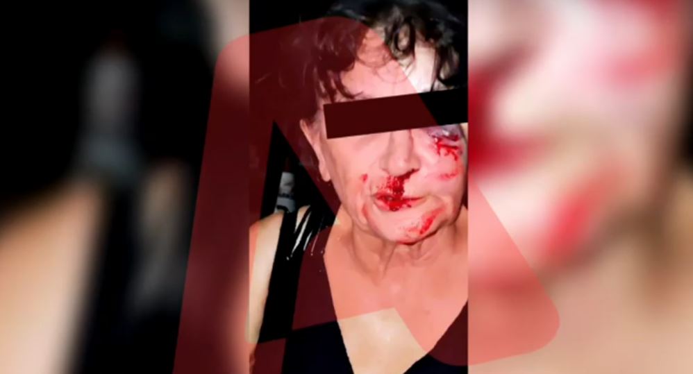 ξυλοδαρμός στην Αίγινα