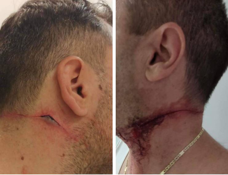 τραυματίες αστυνομικοί