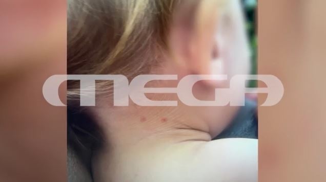 Καβάλα ψύλλοι 