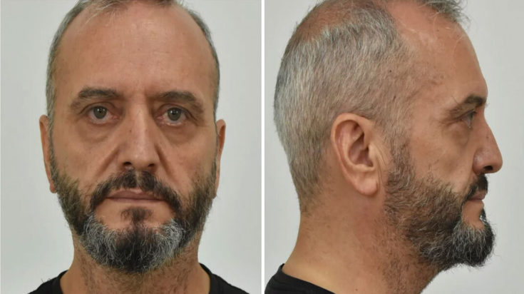 Ηλίας Μίχος