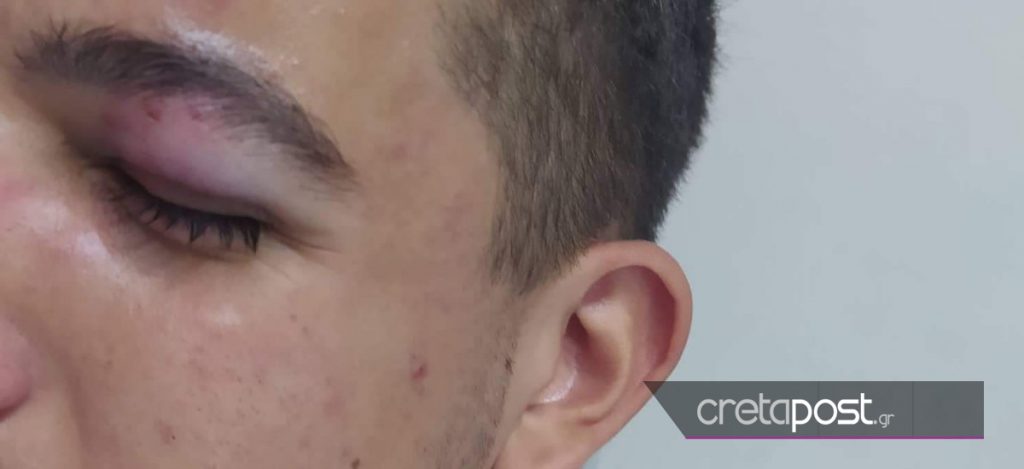 ξυλοδαρμός μαθητή στο Ηράκλειο