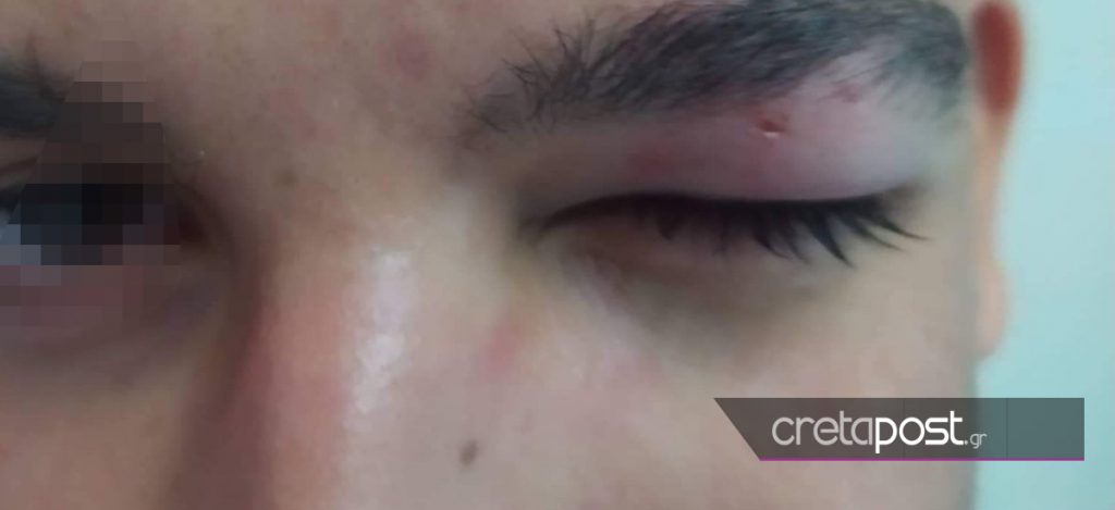 ξυλοδαρμός μαθητή στο Ηράκλειο