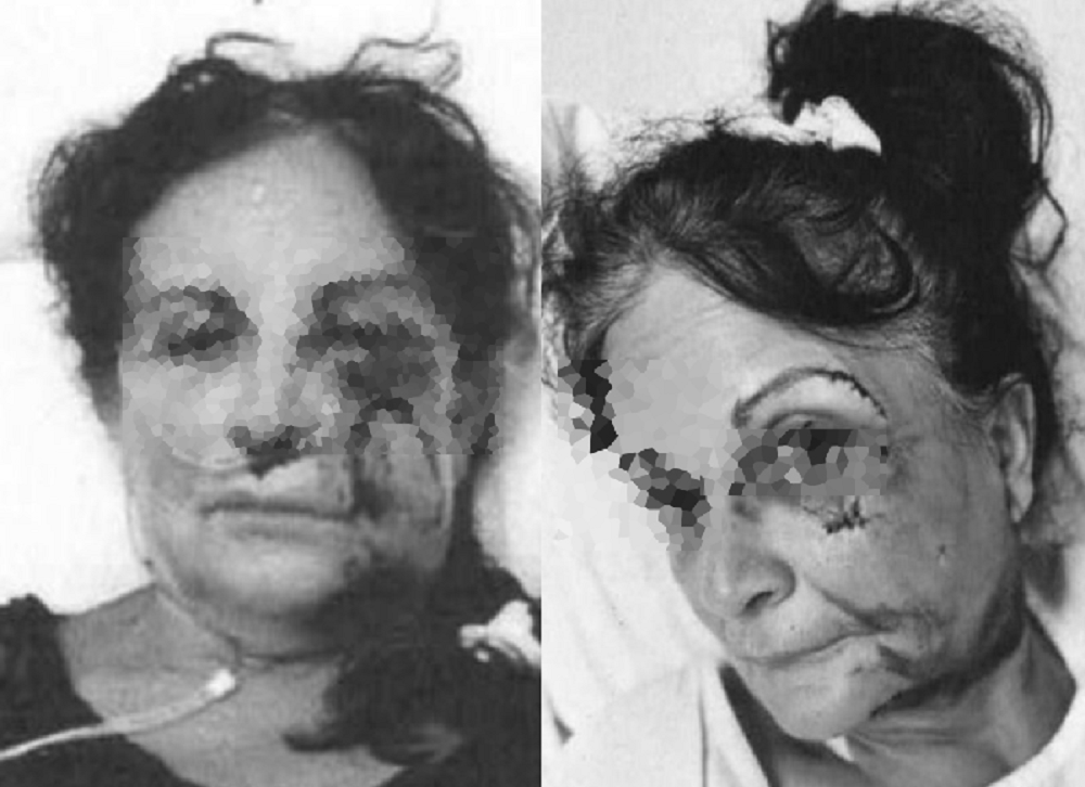 ξενοδόχος Αίγινα ξυλοδαρμός